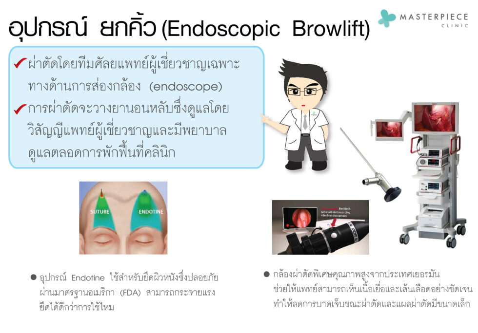 การยกคิ้วเทคนิค (Endoscopic Brow Lift)